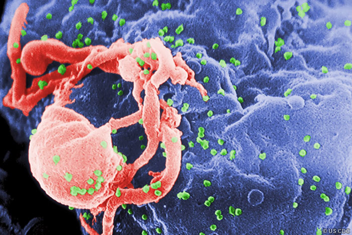 伊巴利珠单抗可治疗多重耐药性HIV感染