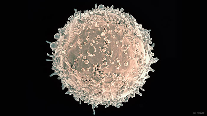 免疫球蛋白G3阻止B细胞对抗HIV感染者体内的病毒